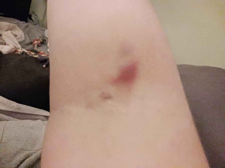 Plasma Donation at BioLife Plasma Services Bossier City, LA